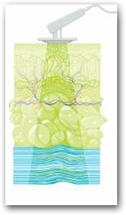 DEEP OSCILLATION travels the depth of tissue layers (skin, connective tissue, subcutaneous fat, muscles, blood and lymph vessels).  &raquo; Click to zoom ->