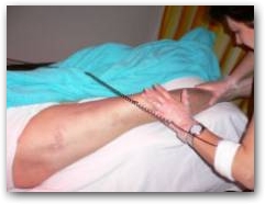 Picture two - post healing of haematoma afer DEEP OSCILLATION therapy applied via the hands on method  &raquo; Click to zoom ->