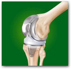 Implanted pins and plates are not a problem for the application of DEEP OSCILLATION therapy, as it is a non-thermal therapy.  &raquo; Click to zoom ->