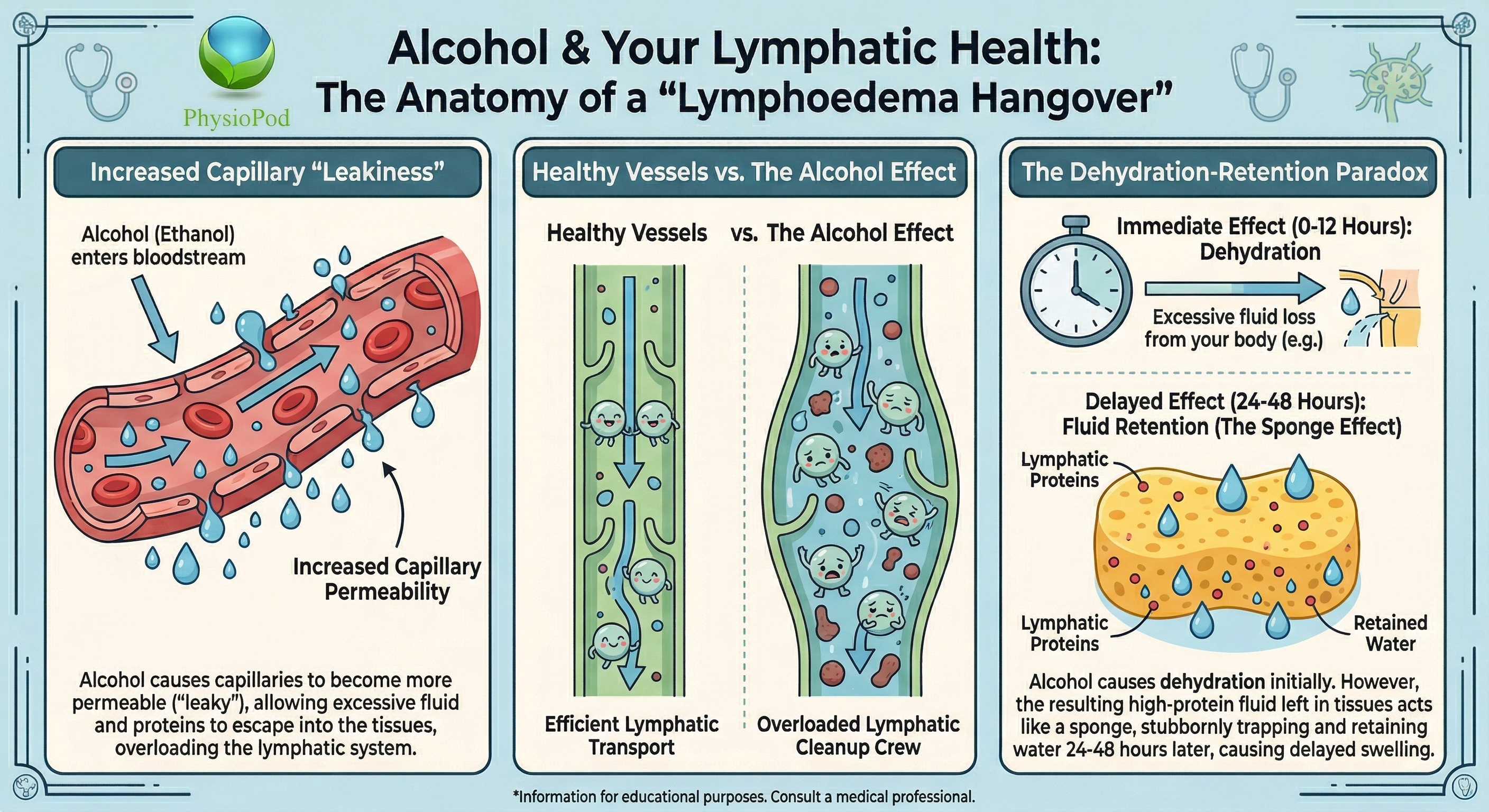 Here is a more concise version that still captures all the essential information for a screen reader:  **Alt Text:**  An infographic by PhysioPod titled "Alcohol & Your Lymphatic Health: The Anatomy of a 'Lymphoedema Hangover'." It breaks down the effects of alcohol into three sections:  1. **Increased Capillary "Leakiness":** Explains that alcohol causes blood vessels to leak excess fluid and proteins into surrounding tissues, overloading the lymphatic system. 2. **Healthy Vessels vs. The Alcohol Effect:** A diagram contrasting normal, efficient lymphatic fluid transport with a swollen, congested lymphatic vessel struggling to clear waste after alcohol use.  3. **The Dehydration-Retention Paradox:** Details how initial dehydration from alcohol (0-12 hours) leaves behind high-protein fluid in the tissues. This acts like a sponge, trapping water and causing delayed swelling 24-48 hours later.   *Disclaimer: Information for educational purposes. Consult a medical professional.*