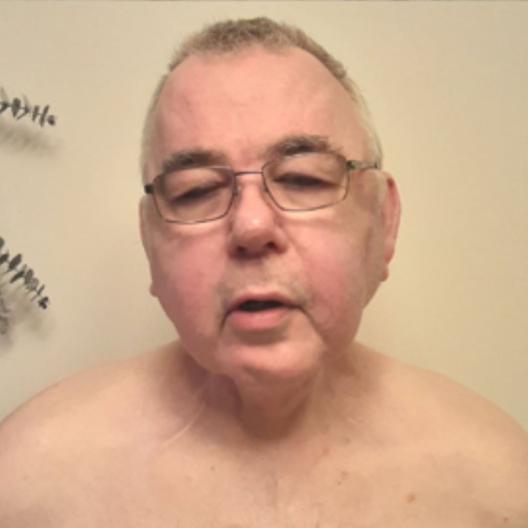 Mr A post deep oscillation later