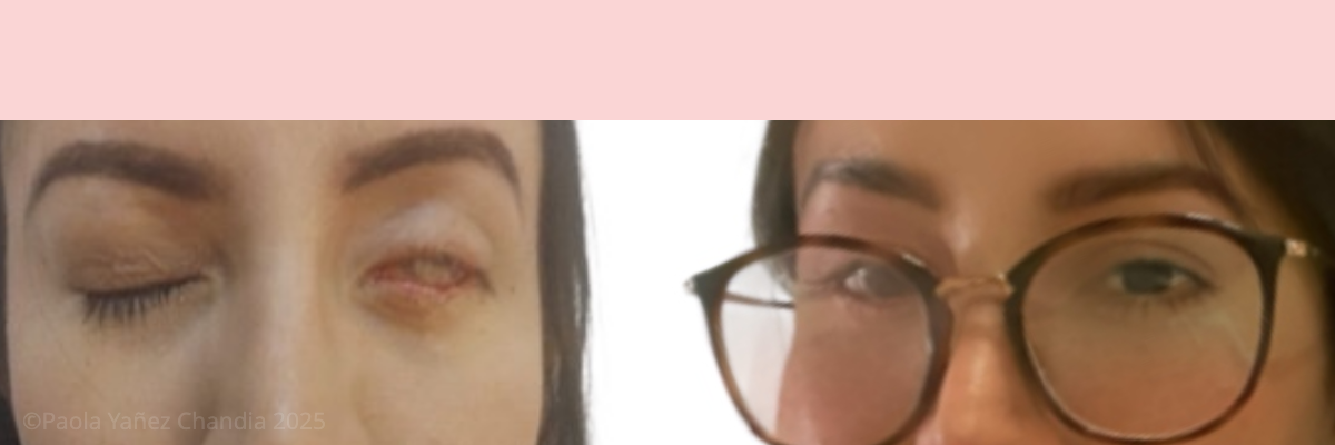 before and after