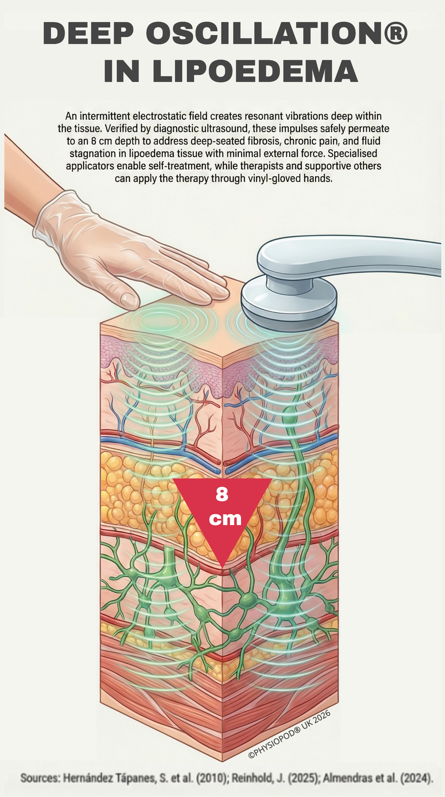 Figure 3: Deep Oscillation® in Lipoedema. An intermittent electrostatic field creates resonant vibrations deep within the tissue. Verified by diagnostic ultrasound, these impulses safely permeate to an 8 cm depth to address deep-seated fibrosis, chronic pain, and fluid stagnation in lipoedema tissue with minimal external force. Specialised applicators enable self-treatment, while therapists and supportive others can apply the therapy through vinyl-gloved hands. Crucially, unlike conventional electrotherapy which acts primarily on the neuromuscular system, Deep Oscillation intervenes directly in the connective tissue—making it specifically effective for addressing the structural fibrosis and pathological adipose changes characteristic of lipoedema. Clinical verification of the 8 cm penetration depth via diagnostic ultrasound provided by Dr. Solangel Hernández Tápanes (2010). © Copyright 2026 PhysioPod® UK Ltd.